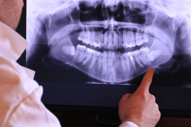 Best Emergency Treatment for Jaw Pain or Injury in La Selva Beach, CA